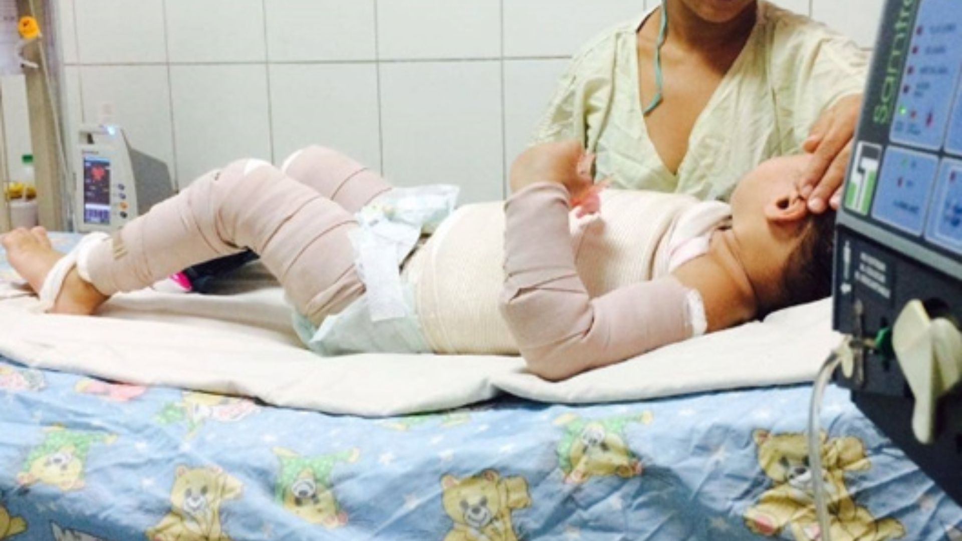 Niño con quemaduras graves recibirá atención médica en EUA
